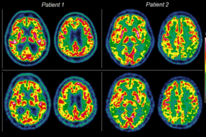 Outreach event – From Particles to Patients: Detector Technology & Molecular Imaging